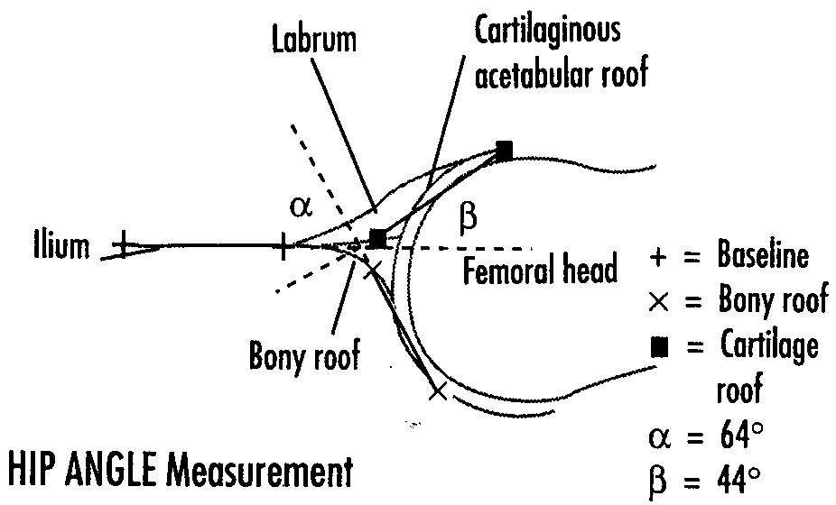 alpha angle hip